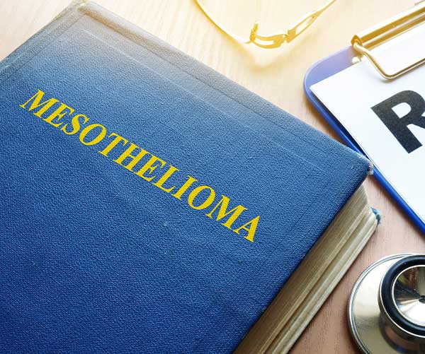mesothelioma